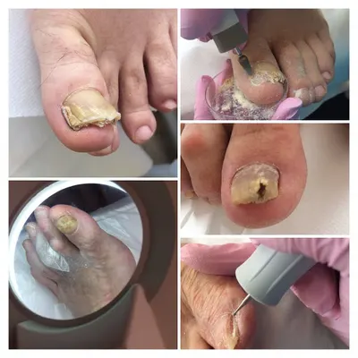 Gabinet Kosmetyczno-Podologiczny Agata Hryncewicz